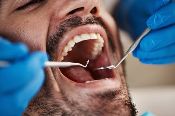 Best Cracked Tooth Emergency Dentist  in Woodsi East, DE