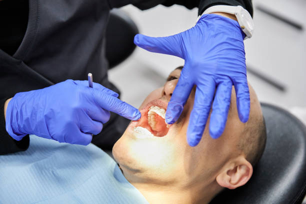Best Emergency Dental Filling Replacement  in Woodsi East, DE
